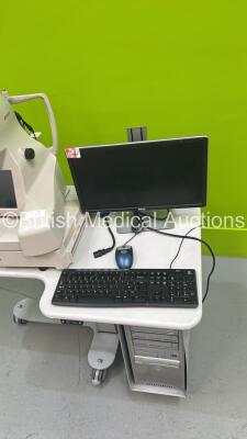 TopCon 3D OCT-2000 Optical Coherence Tomography System on Motorized Table with Accessories (No Power - HDD REMOVED) *S/N 684209* ***IR907*** - 9