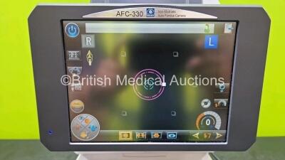 Nidek AFC-330 Non-Mydriatic Auto Fundus Camera *Mfd 2015* (Powers Up and Damaged Case - See Photos) - 3