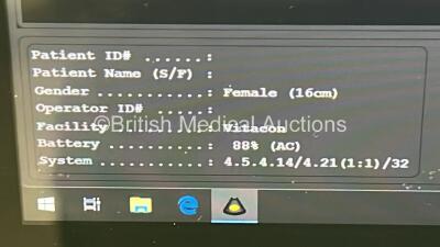 VitaCon VitaScan LT Ultrasound Bladder Scanner Software Version - 4.5.4.14 with Transducer / Probe and Power Supply on Stand (Powers Up) *S/N 01437* - 3