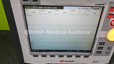 GS Corpuls3 Slim Defibrillator Ref : 04301 (Powers Up, Missing Hinge on Handle) with Corpuls Patient Box Ref : 04200 (Powers Up, Some Options Missing - See Photo) with Pacer, Oximetry, ECG-D, ECG-M, CO2, CPR, NIBP and Printer Options and Corpuls Display U - 2