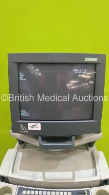 BK Medical Falcon 2101 EXL Ultrasound Scanner *S/N 2003-1841150* (Powers Up) - 3