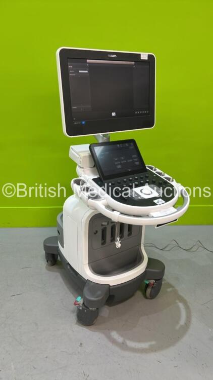 Philips Affiniti 70G Flat Screen Ultrasound Scanner Ref 989605416151 *S/N US715F0693* **Mfd 2015** SVC HW A.0 Software Version 1.7.1.24 with Sony UP-D711MD Digital Graphic Printer (Powers Up, See Machine for Probe Report) ***CD058***