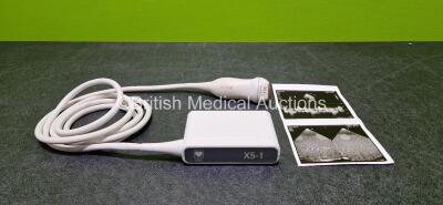 Philips X5-1 Ultrasound Transducer / Probe (Mark on Head - See Photo) *See Photo for Scan Picture*