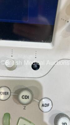 Toshiba Aplio 500 TUS-A500 Flat Screen Ultrasound Scanner *S/N WAD1682869* **Mfd 2016** Software Version AB_V6.60*R001 (Powers Up - Missing Dial - See Pictures) *See PDF for Ultrasound Report* - 11