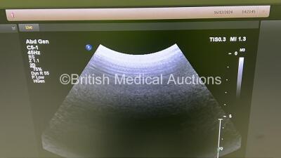 Philips Epiq 5G Flat Screen Ultrasound Scanner Ref 989605408541 *S/N US814C0506* **Mfd 2014** SVC HW A.0 Software Version 1.5.6.850 with 3 x Transducer / Probes (C5-1 / C9-2 / L12-5) (Powers Up) ***CD117*** - 8