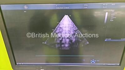 GE Vivid E95 Flat Screen Ultrasound Scanner Ref v202 with OLED *Mfd - 2019* Application Software 203 Revision 88 System Software 203-10.3 (Powers Up) with 1 x M5SC-D Transducer / Probe *Mfd - 2019* **SN AU10225 / 310379YP3* **CD224** - 10