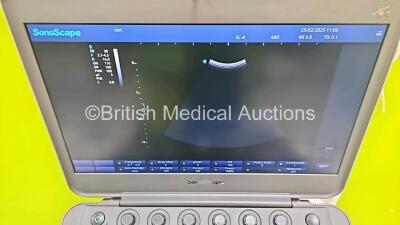 SonoScape X5 Flat Screen Portable Ultrasound Scanner *Mfd - 2018* Software Version R1.0 (Powers Up, Missing Part on Probe Lock - See Photo) on Stand with 3C-A Curved Array Probe *SN 0489555136* **CD205** - 8