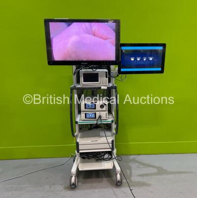 February 2026 Endoscopy Stack Systems | British Medical Auctions