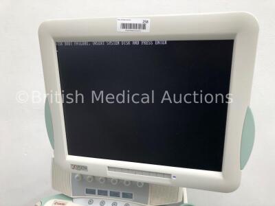 Esaote MyLab60 X Vision Ultrasound Scanner Model 6150 010 (Hard Drive Removed-Missing Dials-See Photos) * SN 3643 * * Mfd 2008 * - 3