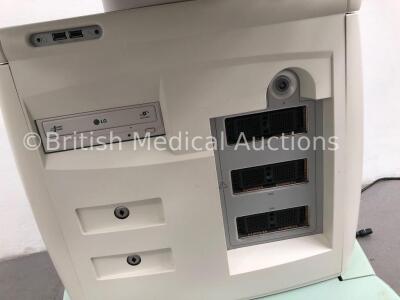 Esaote MyLab60 X Vision Ultrasound Scanner Model 6150 010 (Hard Drive Removed-Missing Dials-See Photos) * SN 3643 * * Mfd 2008 * - 4