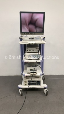 Olympus Stack Trolley Including Olympus OEV191 Monitor,Stryker Endoscopy Digital Camera 988i3 Chip Camera Control Unit,Stryker 988i Camera Head,Olympu