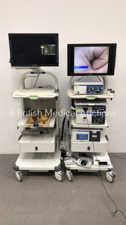 2 x Olympus Stack Trolleys with 2 x Sony Monitors, Olympus UHI-4 Insufflator, Olympus Evis Exera III CV-190 Digital Processor, Olympus Visera Elite CLV-S190 Light Source, Olympus IMH-20 Data Management Unit, Olympus OTV-S7Pro H Camera Head, Olympus HD End