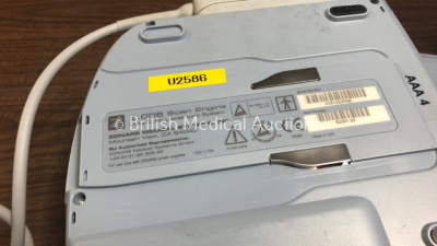 Zonare Medical Systems Z One Portable Scanner with 1 x Zonare Medical Systems P4-1c Transducer / Probe, 1 x Zonare Medical Systems L10-5 Transducer / Probe and 1 x HP L1750 Monitor In Carry Case (Untested Due to No Power Supply and Missing Battery) *03512 - 3