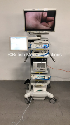 ConMed Linvatec Stack Trolley with ConMed Linvatec HD 1080p Monitor, MedXChange Touch Screen Monitor, ConMed Linvatec HD 1080p Camera Control Unit, ConMed IM4120 Camera Head, ConMed Linvatec Xenon 300 Watt Light Source, SilverStone Data Management System,