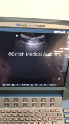 SonoSite MicroMaxx Portable Ultrasound Machine Ref P08840-20 *S/N WK03T1* **Mfd 06/2010** Boot Version 30.80.306.030 ARM Version 30.80.306.030 with 2 x Transducers / Probes (C60e-5-2 MHz Ref P07633-30 *Mfd 07/2012* and ICT/8-5 MHz Ref P04538-16 *Mfd 11/20 - 9