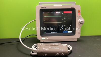 Mindray iMEC 10 Patient Monitor Including ECG, SpO2, T1, T2 and NIBP Options with 1 x BP Cuff and Hose (Powers Up) *315603 / EX-8C064261*