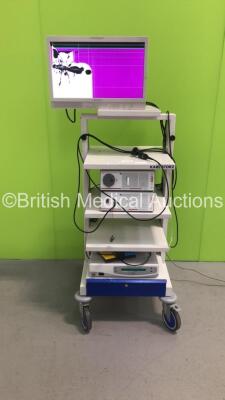 Karl Storz Stack Trolley Including Sony LCD Monitor,Richard Wolf Endolight LED 1.2 Light Source Unit,Richard Wolf Endocam Performance HD Camera Control Unit, Richard Wolf 5514901 PAL Camera Head and Gynecare Versapoint Unit with Footswitch (Powers Up-Unab