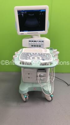 Esaote MyLab70 X Vision Ultrasound Scanner Ref 970 6150 010 with 2 x Transducers/Probes (1 x CA631 and 1 x LA523) and Sony Video Graphic Printer UP-897MD (Powers Up-See Photos for Air Scans) * SN 5410 * * Mfd 2011 *