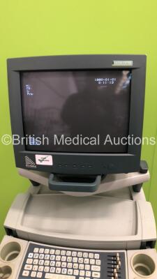 B-K Medical Falcon 2101 EXL Ultrasound Scanner with Sony Video Graphic Printer UP-895MD (Powers Up) * SN 2003-1841150 * - 4