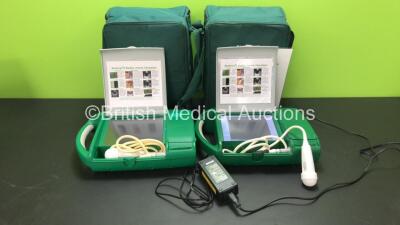 2 x Bardscan IIs Ref PA-00262 Bladder Scanners with 2 x Probes, 2 x Batteries, 2 x AC Power Supplies in 2 x Carry Bags (Both Power Up)