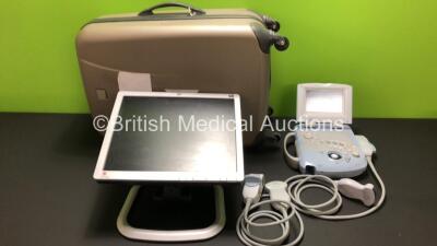 Zonare Z.One Diagnostic Ultrasound System (Missing Mouse Surround - No Battery or Power Supply) with 2 x Transducer - Probes (C5-2) 1 x HP L1750 Monitor Screen and Carry Case