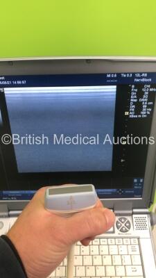 GE Logiq e Portable Ultrasound Scanner Ref 5322678 *S/N 141073WX7* **Mfd 03/2010** Software Version R5.2.2 with 1 x Transducer / Probe (12L-RS Ref 5141337 *Mfd 11/2015**) on GE Mobile Cart (Powers Up) - 5