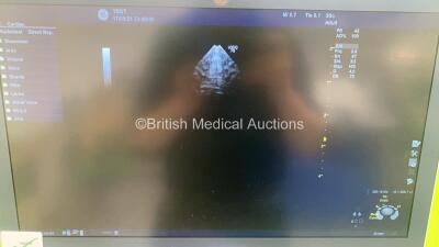 GE Logiq P9 Flat Screen Ultrasound Scanner Ref 5641037 *S/N 299675SU9* **Mfd 08/2015** Software Version R1 Software Revision 0.3 with 4 x Transducers / Probes (3Sc-RS Ref 47237516 *Mfd 08/2015* / C1-5-RS Ref 5384874 *Mfd 08/2015* / 12L-RS Ref 5141337 *Mfd - 7