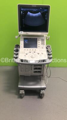 Toshiba Aplio 400 TUS-A400 Flat Screen Ultrasound Scanner *S/N TDB1422264* **Mfd 02/2014** Software Version AB_V4.00*R102 with 1 x Transducer / Probe (PVT-375BT *Mfd 01/2015*) and Sony UP-D897 Digital Graphic Printer (Powers Up - Small Marks to Lower Trim