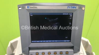 SonoSite Titan Portable Ultrasound Scanner Ref P04541-02 *S/N 0347N5* **Mfd 05/2005** Boot Version 21.80.202.016 ARM 21.80.203.014 Version with 2 x Transducer / Probes (L38/10-5 MHz Ref P04101-51 *Mfd 05/2005* and C15/4-2 MHz Ref P04102-02 *Mfd 03/2005*) - 6