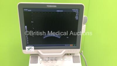 Toshiba Nemio MX SSA-590A Ultrasound Scanner *S/N 99A11Y2699* **Mfd 11/2011** with 1 x Transducer / Probe (PVM-375AT) and Sony UP- D897 Digital Graphic Printer (Powers Up) ***IR037*** - 3