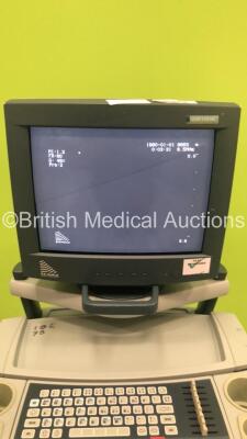 BK Medical Hawk 2102 EXL Ultrasound Scanner *S/N 2003 - 1845379* with 1 x Transducer / Probe (Type 8663 5-8 MFI) and Sony UP-895MD Video Graphic Printer (Powers Up) (C) - 3