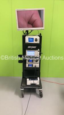 Stryker Stack Trolley with Stryker Vision Elect HDTV Surgical Viewing Monitor, Stryker Pneumo Sure High Flow Insufflator, Stryker SDC Ultra HD Information Management System, Stryker L9000 LED Light Source, Stryker 1288HD High Definition Camera Control Uni