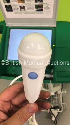 Bardscan II Bladder Volume Scanner with Transducer on Stand (Powers Up - Broken Lid) *S/N 00151* - 3