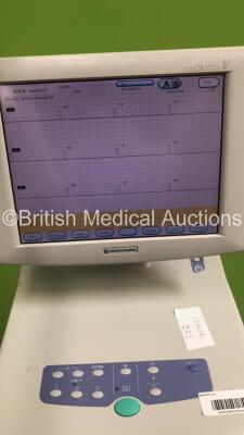 Nihon Kohden ECG-1550K Electrocardiograph on Stand with 1 x 10-ECG Lead (Powers Up) * SN 00993 * - 3