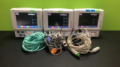 3 x Fukuda Denshi DS-7100 Patient Monitors Including ECG, SpO2, BP, TEMP, NIBP and Printer Options, 3 x BP Hose, 3 x SPO2 Finger Sensors and 3 x ECG Lead (All Power Up)