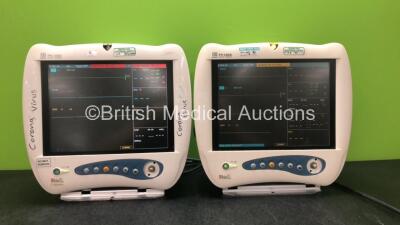 2 x Mindray PM-7000 Patient Monitors with with ECG, T1, T2, SPO2, Printer and NIBP Options (Both Power Up with Some Missing Casing - See Photo) *SNCE05122470 - CE78100965*