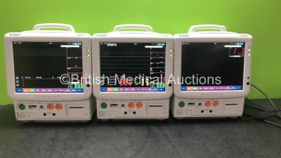 3 x Fukuda Denshi DS-7200 Patient Monitors Including ECG/RESP, SpO2, NIBP, BP1, BP2, TEMP1, TEMP2, CO2 and Printer Options (All Power Up)