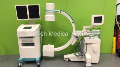 Ziehm Vision Mobile C-Arm with Dual Flat Screen Image Intensifier *S/N 9891* (HDD REMOVED)