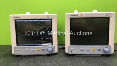 2 x Mindray Datascope Trio Patient Monitors Including ECG, SpO2, T1 and NIBP Options (Both Power Up, 1 with Blank Screen-See Photo) *GL*