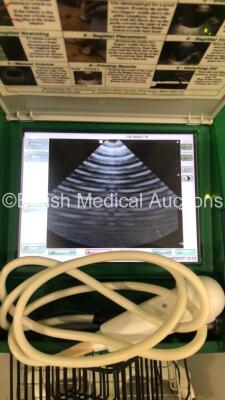 BARDScan II Bladder Scanner Software Version 1.0.5 Build 9E with 1 x Transducer / Probe on Stand (Powers Up) *S/N 508301* - 6