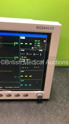 EDAN iM8 Patient Monitor with Printer,ECG,NIBP,SpO2,T1 and T2 Options (Powers Up in Excellent Condition) - 2