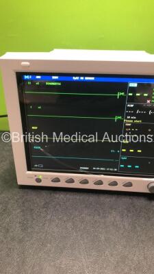 EDAN iM8 Patient Monitor with Printer,ECG,NIBP,SpO2,T1 and T2 Options (Powers Up in Excellent Condition) - 3