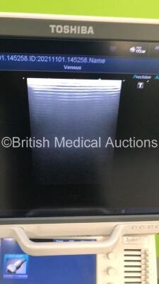 Toshiba Aplio 500 Flat Screen Ultrasound Scanner Model TUS-A500 Software Version AB_V3.00*R002 with 1 x Transducer/Probe (PLT-1204BT * Mfd March 2012 *),Sony Digital Graphic Printer UP-D897 and Mitsubishi Digital Color Printer CP30DW (Powers Up-General Ma - 3