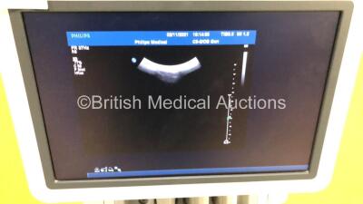 Philips iU22 Flat Screen Ultrasound Scanner on E.2 Cart *S/N 02XT02* **Mfd 11/2007** Software Version 5.2.2.44 with 4 x Transducers / Probes (X3-1 (Damage to Cable) , L17-5, C8-4v (Will Not Place in Transducer Port) and C5-2) and Sony UP-D897 Digital Grap - 9