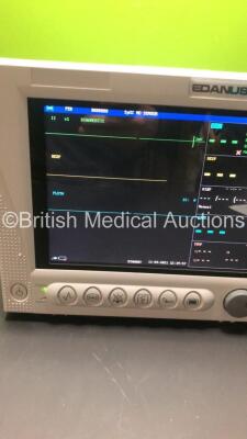 EDAN USA IM8A Patient Monitor with Printer,CO2,IBP1,IBP2,ECG,NIBP,SpO2,T1 and T2 Options (Powers Up-In Excellent Condition) * Mfd 2014 * - 3