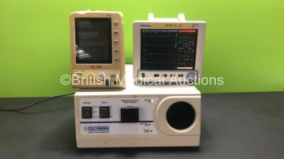 Mixed Lot Including 1 x Eschmann Smoke Evacuation Unit (Powers Up), 1 x Mindray Datascope Trio Patient Monitor with SPO2, T1, ECG and NIBP Options (Powers Up, Missing Buttons - See Photo) and 1 x Edan M3 Vital Signs Monitor (No Power) *M232021011586SVQ / 