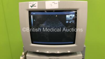 Acuson Sequoia C256 Ultrasound Scanner *S/N 53016* Version 5.09 with 2 x Transducers / Probes (8L5 and 3v2c) and Sony UP-890MD Video Graphic Printer (Powers Up in French - Missing Dials / Damage to Machine- See Pictures) ***IR249*** - 2