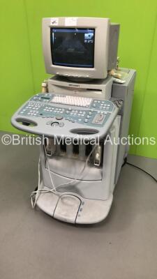 Acuson Sequoia C256 Ultrasound Scanner *S/N 53016* Version 5.09 with 2 x Transducers / Probes (8L5 and 3v2c) and Sony UP-890MD Video Graphic Printer (Powers Up in French - Missing Dials / Damage to Machine- See Pictures) ***IR249*** - 10