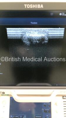 Toshiba Aplio 500 TUS-A500 Flat Screen Ultrasound Scanner *S/N WAB1572298* **Mfd 07/2015** Software Version AB_V5.10*R102 with 3 x Transducers / Probes (PVT-674BT *Mfd 07/2015* / PLT-705BT *Mfd 03/2015* and PVT-375BT *Mfd 03/2019*) and Sony UP-D898MD Dig - 12