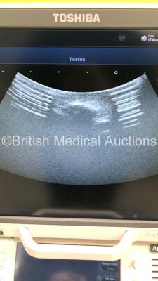 Toshiba Aplio 500 TUS-A500 Flat Screen Ultrasound Scanner *S/N WAB1572298* **Mfd 07/2015** Software Version AB_V5.10*R102 with 3 x Transducers / Probes (PVT-674BT *Mfd 07/2015* / PLT-705BT *Mfd 03/2015* and PVT-375BT *Mfd 03/2019*) and Sony UP-D898MD Dig - 15